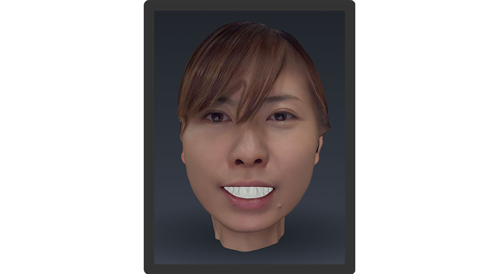 Bellus3D Dental Proの画像