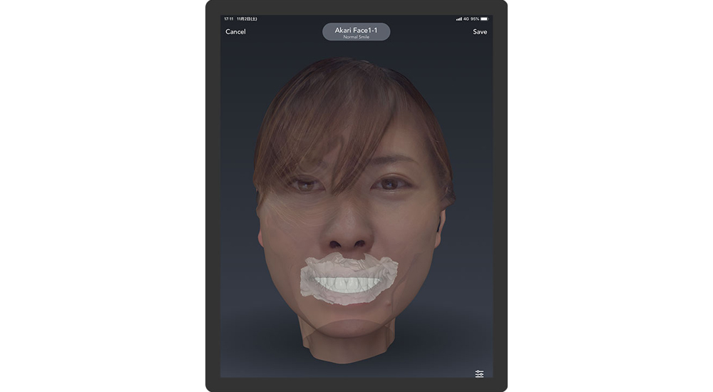 Bellus3D Dental Proの画像