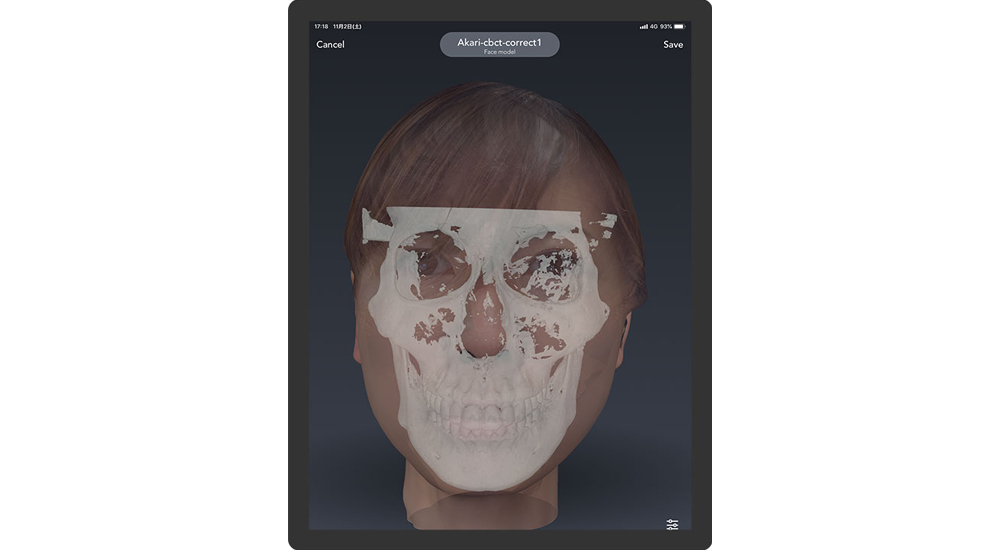Bellus3D Dental Proの画像