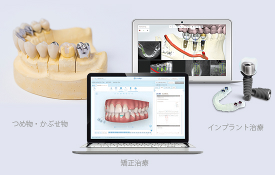 Bellus3D Dental Proのメリット