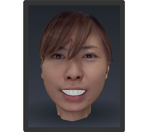 Bellus3D Dental Proの画像