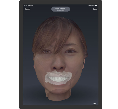 Bellus3D Dental Proの画像