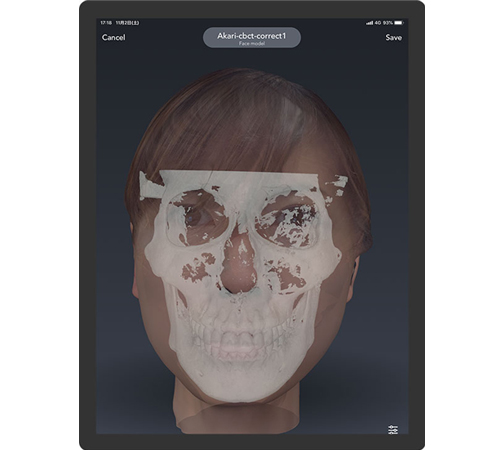 Bellus3D Dental Proの画像